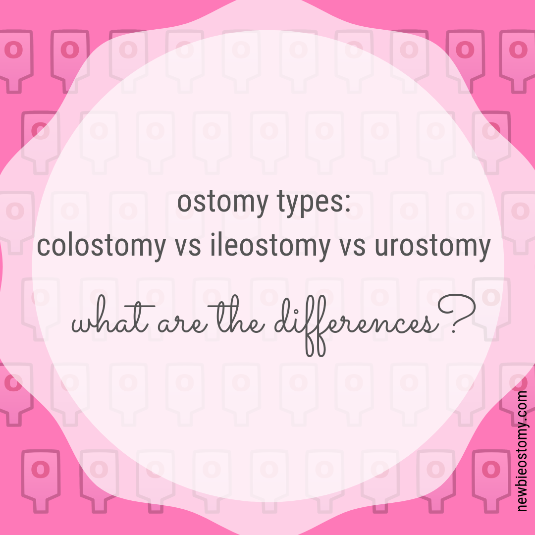 Ostomy Vs Colostomy Vs Ileostomy Vs Urostomy. What’s The Difference ...